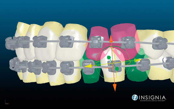 Insignia diagram