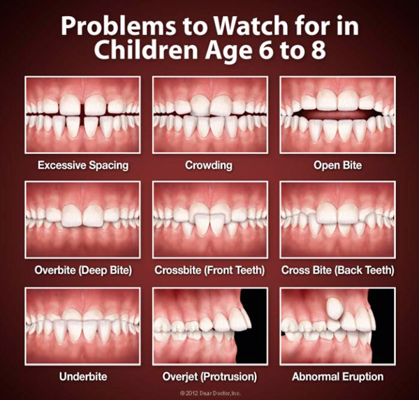 problems with childrens teeth